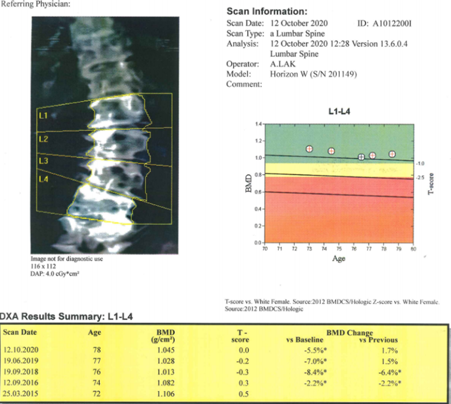 Wynik_badania_DXA_i_TBS_u_78letniej_pacjentki_ze_złamaniami_kompresyjnymi.png